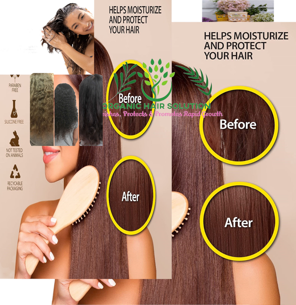 Shampoo & Conditioner -Tea Tree- Aloe Vera-Jojoba seed- Argan- Vitamin E Set - for Itchy and Dry Scalp, Sulfate Free, Paraben Free