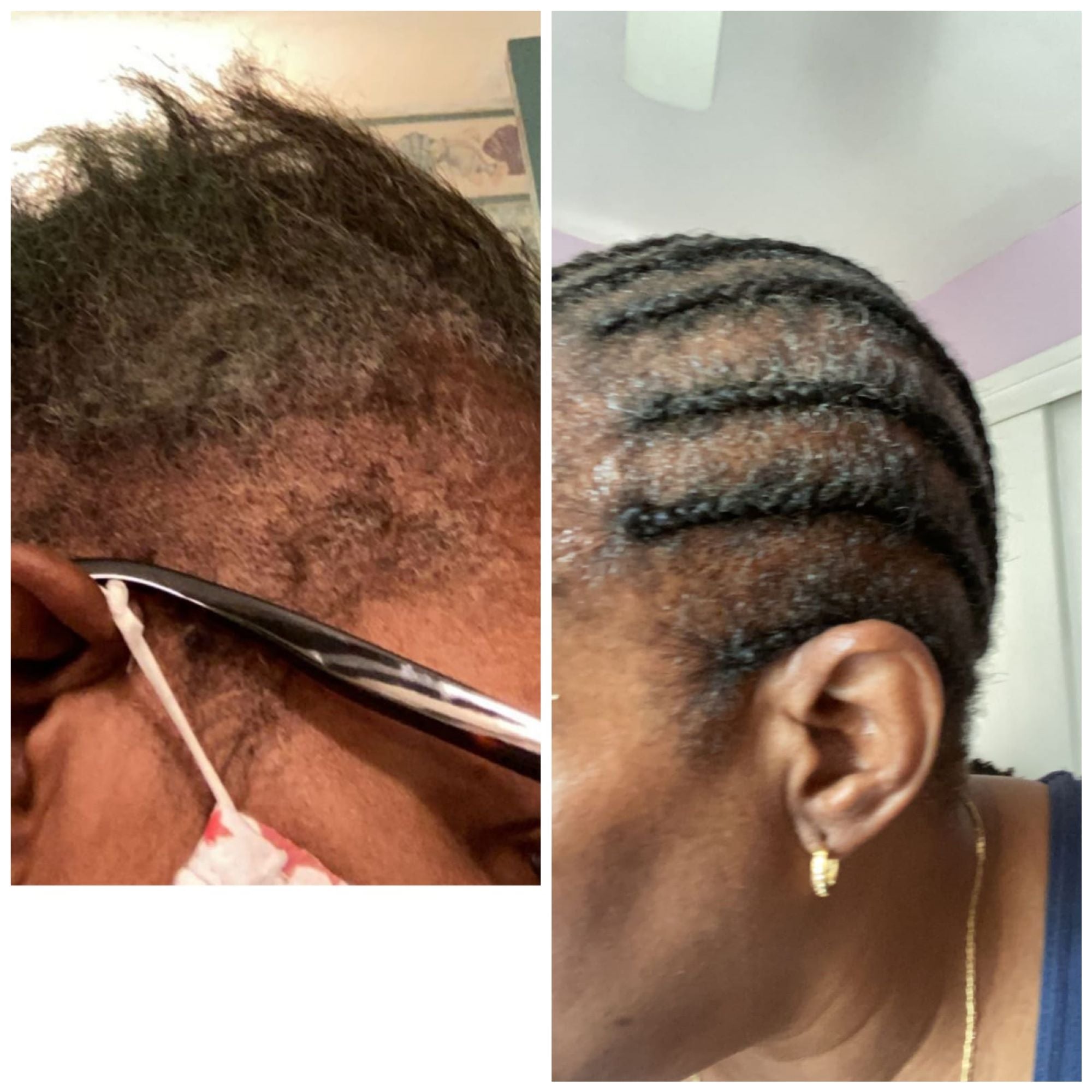 HAIR GROWTH TREATMENT OIL with Peppermint Oil, Tea Tree Oil, Argan oil, Jojoba seed, Avocado oil, Castor oil, Sweet Almond, Vitamin E Oil for Scalp and Hair