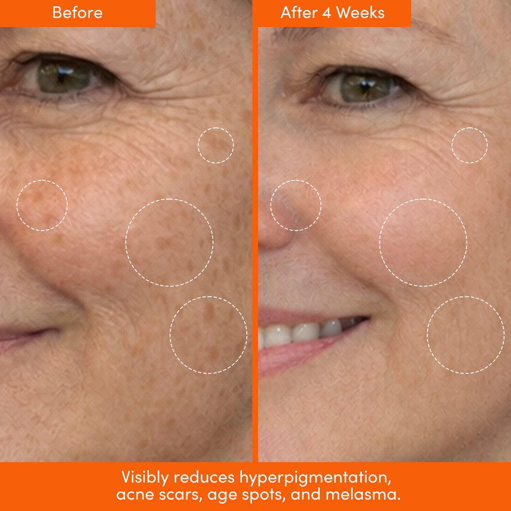 THE PLACENTA FACIAL Dark Spot Serum + Barrier Repair Cream Bundle