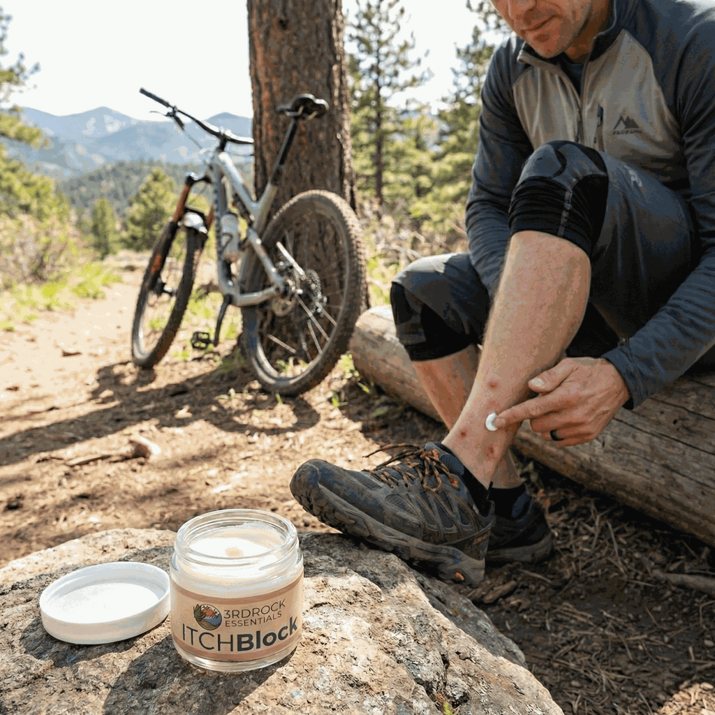 ITCHBlock™ All Natural Itch Relief Cream