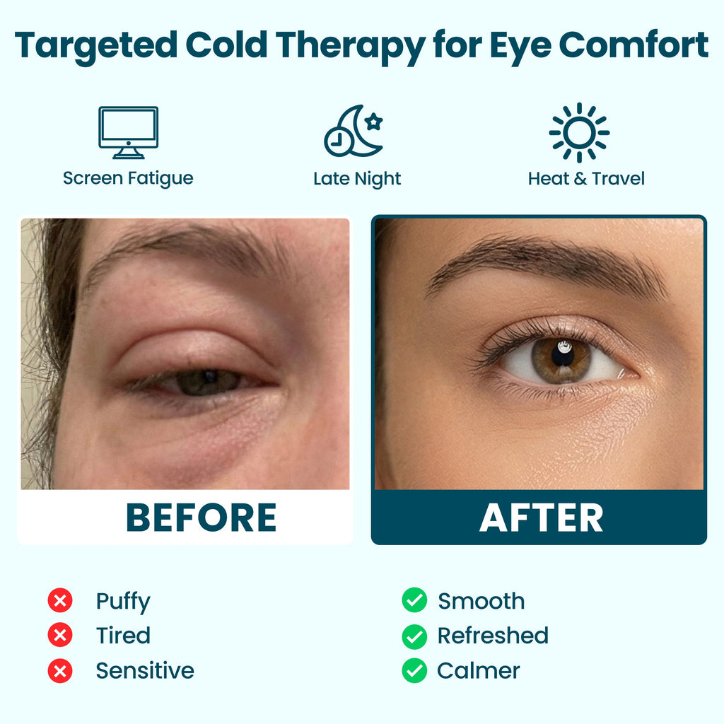 Targeted cold therapy eye mask before and after comparison for puffy, tired, sensitive eyes, showing smoother, refreshed, calmer eye comfort for screen fatigue, late nights, heat and travel.