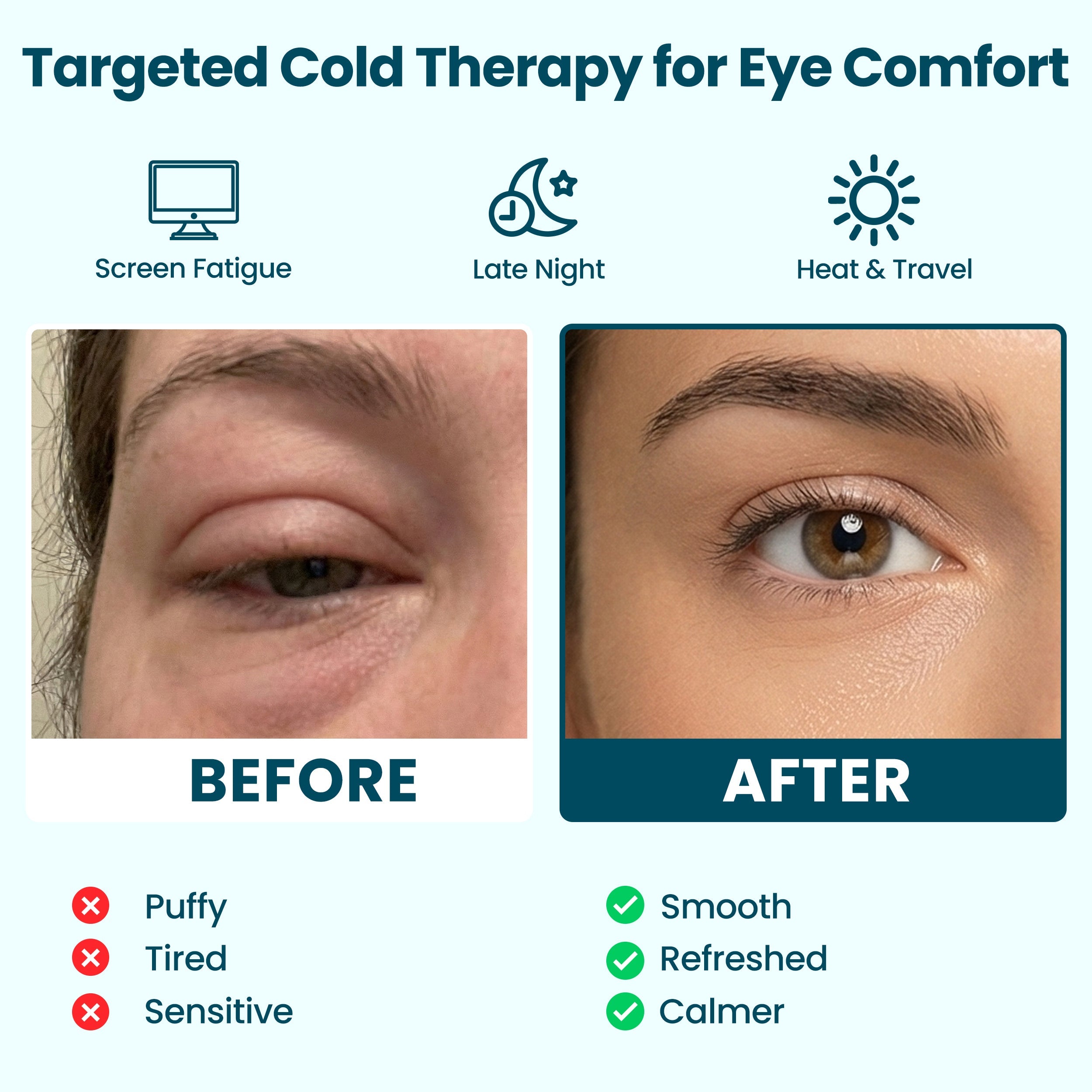 Targeted cold therapy eye mask before and after comparison for puffy, tired, sensitive eyes, showing smoother, refreshed, calmer eye comfort for screen fatigue, late nights, heat and travel.
