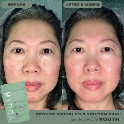 Before and after comparison of a woman's face with text indicating product effects.