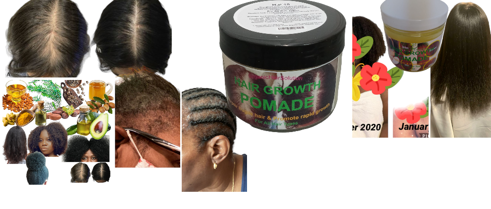 Wholesale-Hair Growth Pomade Grease- For Stronger, Thicker Longer Hair (pack 24)