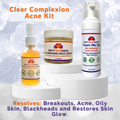 Clear Complexion Acne Kit