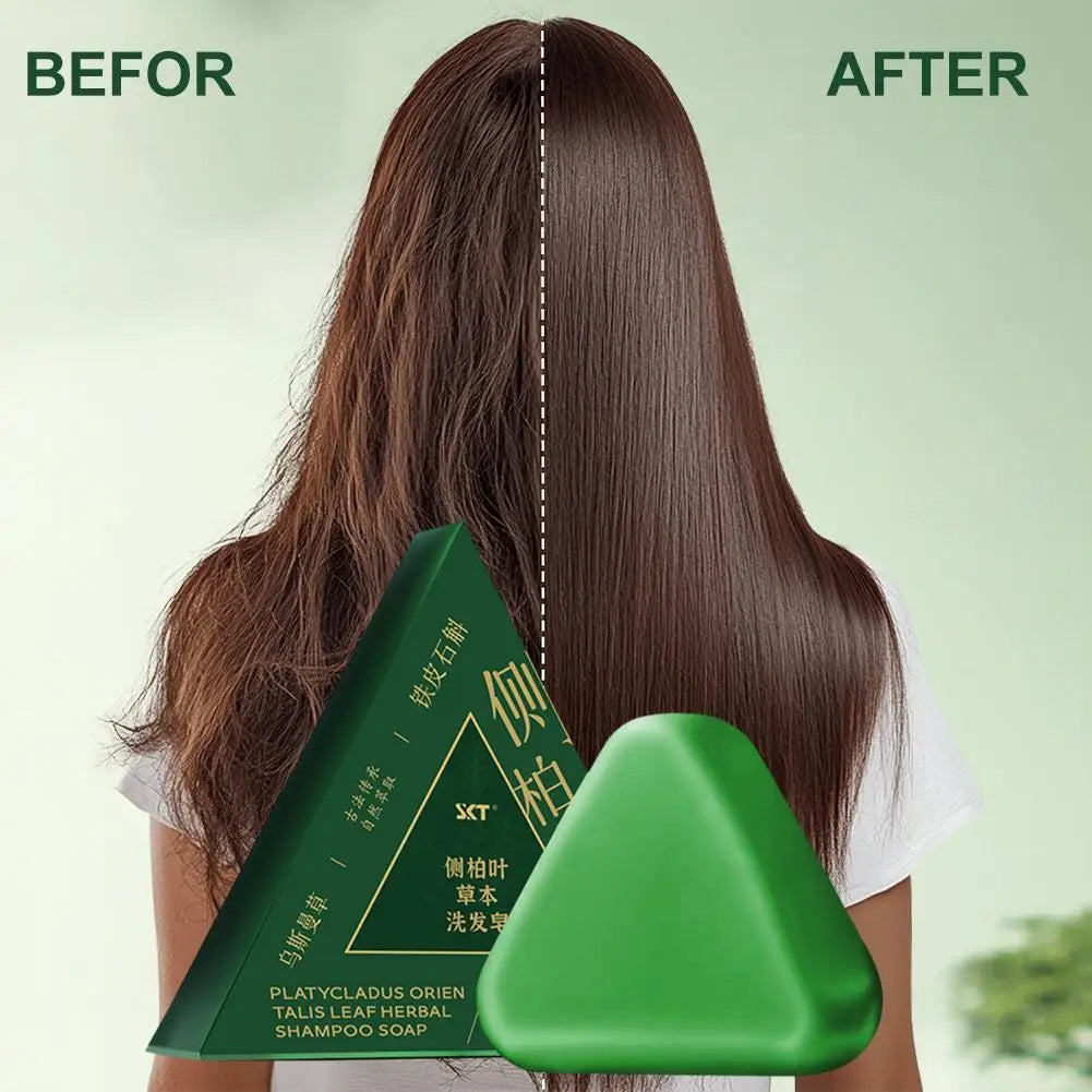 Platycladus Orientalis Shampoo Bar Natural Herbal Soap For Hair Loss Controls Oil Strengthens Root Shampoo Soap Hair Accessories