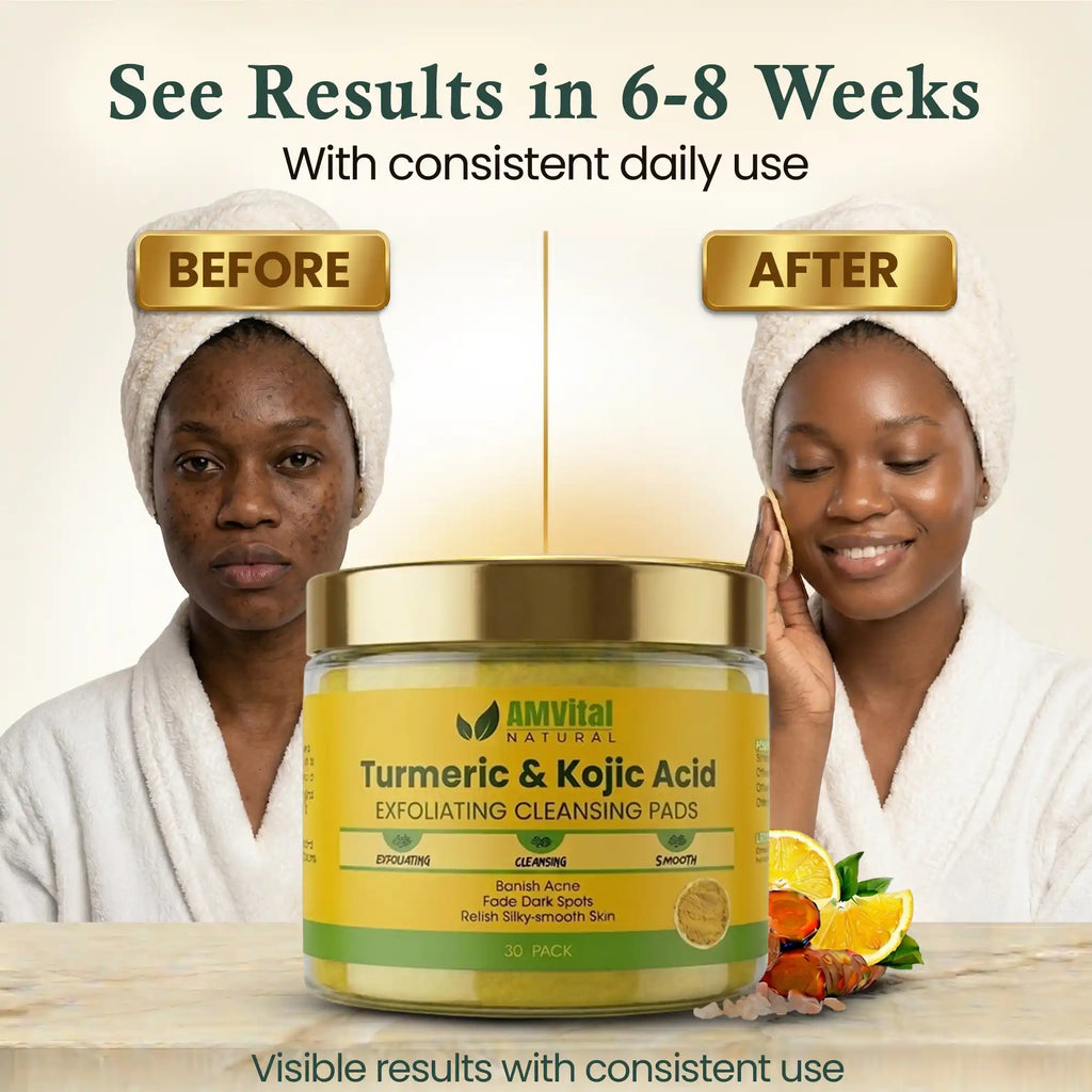 AMVital Turmeric Kojic Acid Cleansing Pads
