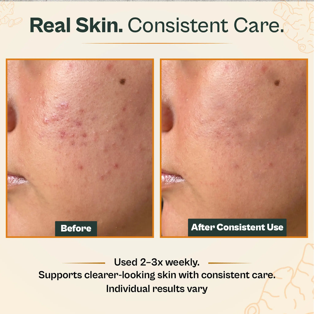 AMVital Turmeric Vitamin C Clay Mask