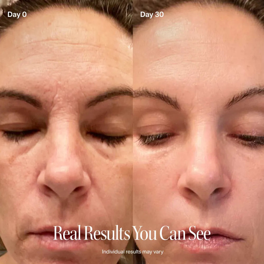 mSolaWave 4-in-1 Red Light Therapy Wand before and after 30 days showing visibly smoother, firmer, more radiant-looking skin and reduced appearance of fine lines and wrinkles.