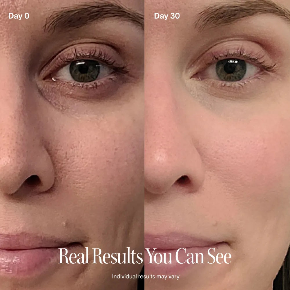 SolaWave 4-in-1 Red Light Therapy Wand before and after 30 days showing visibly smoother, firmer, brighter-looking skin with reduced appearance of fine lines, under-eye darkness and signs of aging.