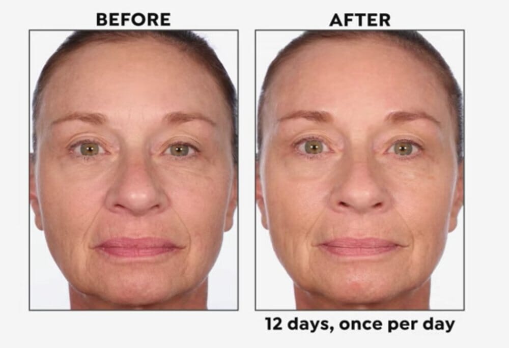 Black Rice 5-Day Brightening Serum