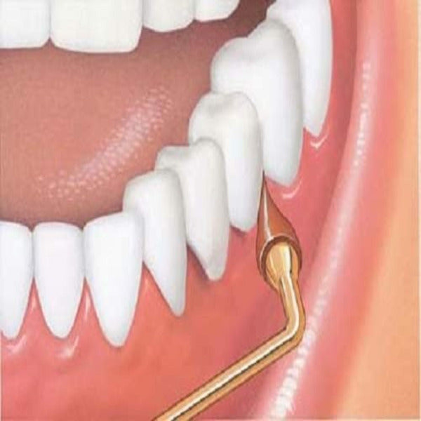 Sunstar GUM GUM  Stimulator Rubber Tip Refills