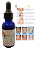 Organic Toenail Fungus Treatment Extra Strength - nail repair, toenail softener yellow toenail treatment, ingrown nail and foot fungus treatment extra strength