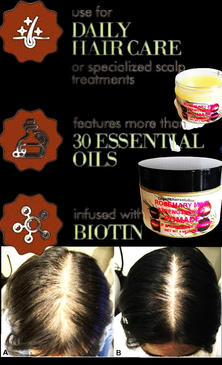 Wholesale-Organics Rosemary Mint Strengthening Hair Pomade, Grease-Scalp & Hair Treatment (24 pack)