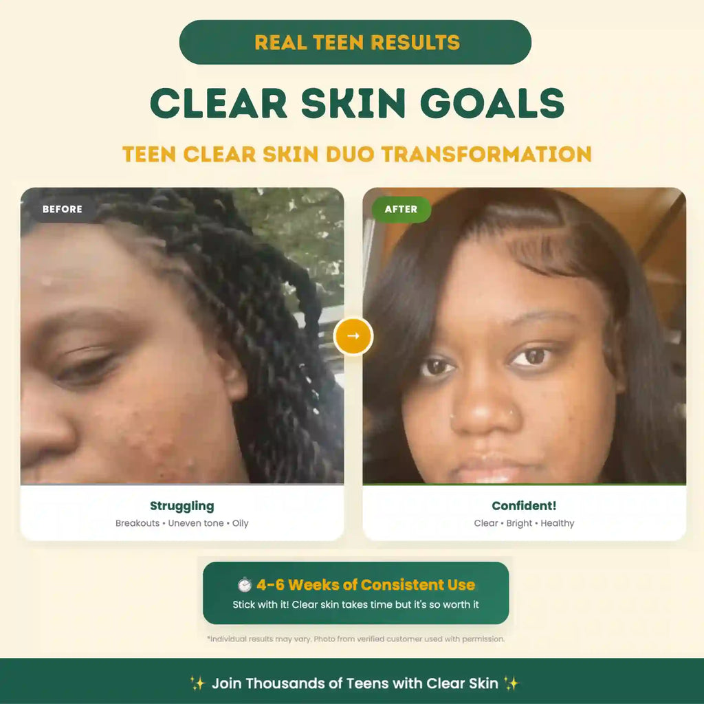 Teen Clear Skin Duo