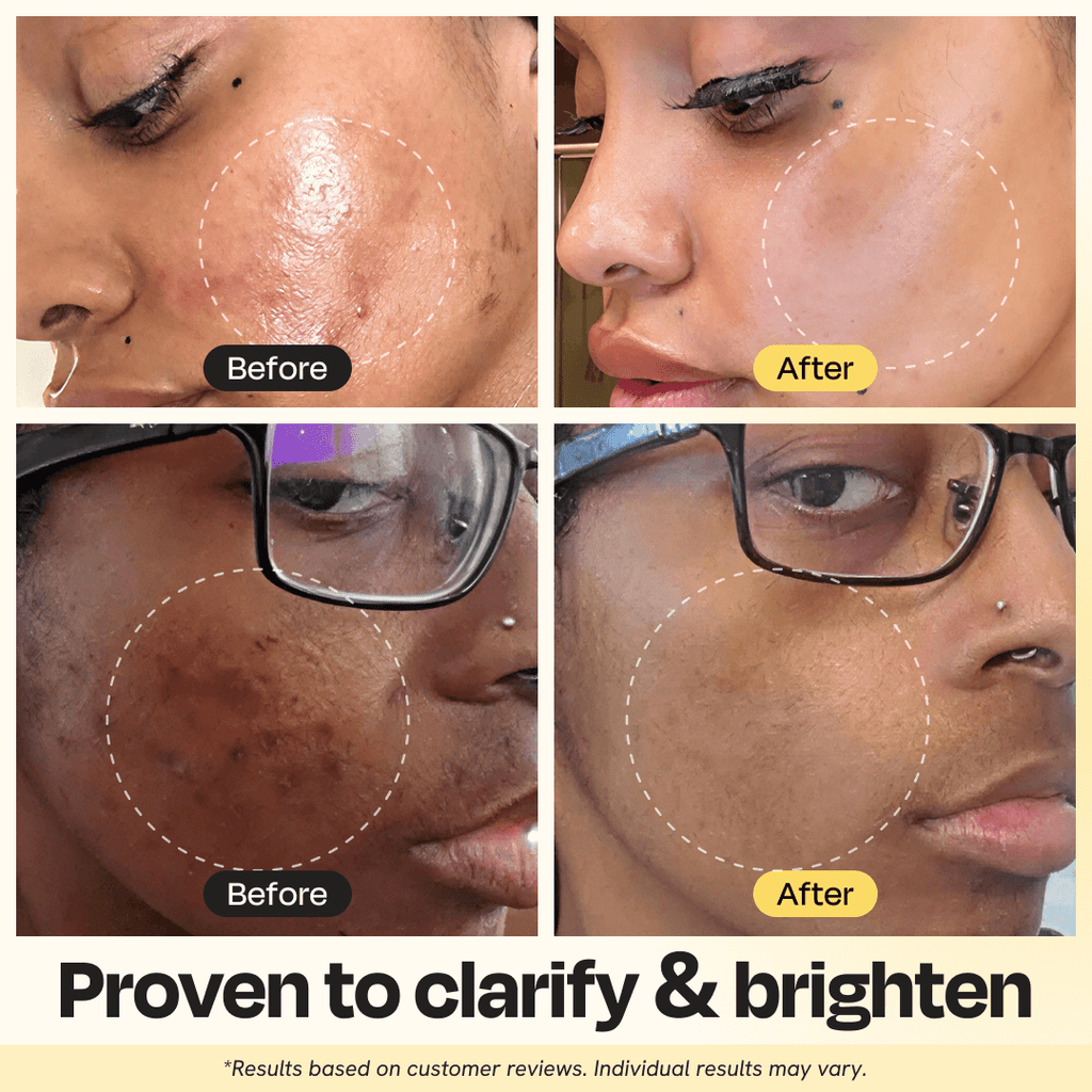 Before and after comparison of a person's face with text indicating product effectiveness.